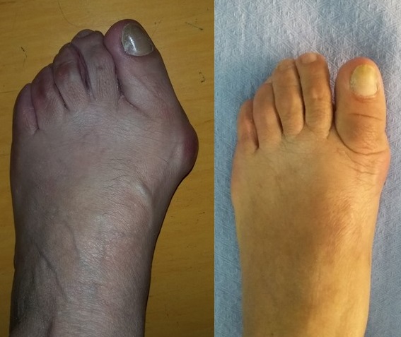 Prima e dopo l'intervento